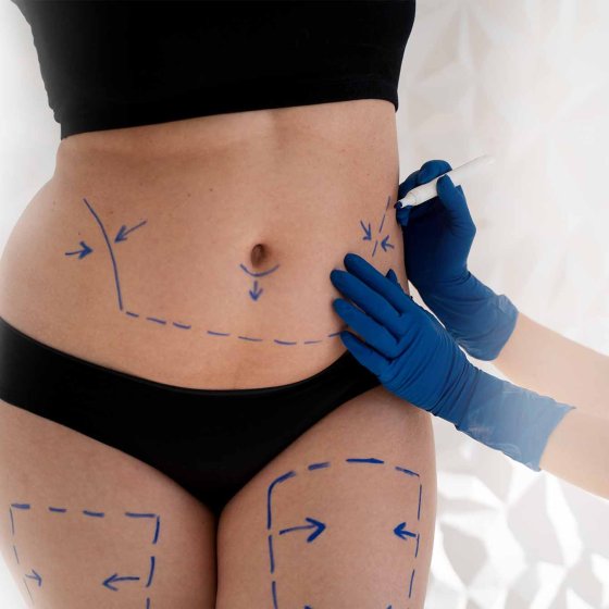 body sculpting surgery dr. chris reuter german plastic surgeon in abu dhabi 2